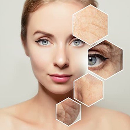 Anti Aging Treatment - Joven Skin Hair & Laser Clinic