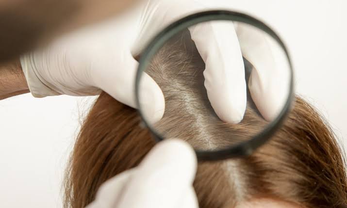 Hair loss evaluation - Joven Skin Hair & Laser Clinic