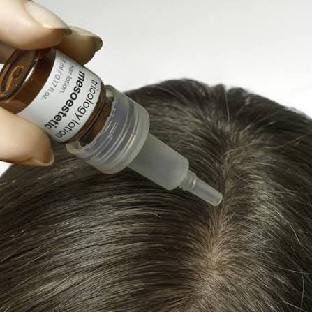 Mesotherapy at Joven