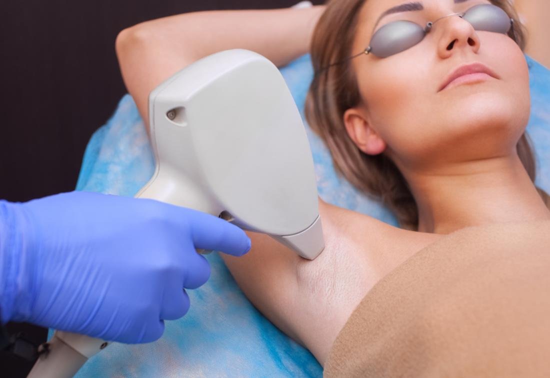 Laser hair reduction at Joven