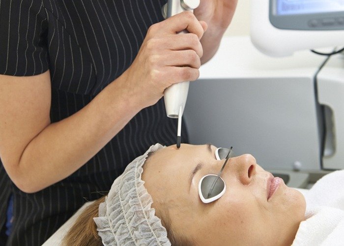 Q Switch Laser - Joven Skin Hair & Laser Clinic