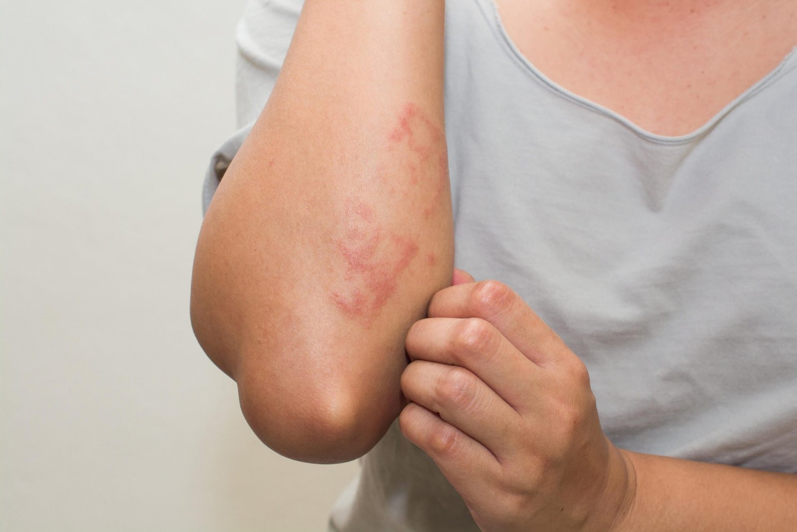 autoimmune scaled - Joven Skin Hair & Laser Clinic