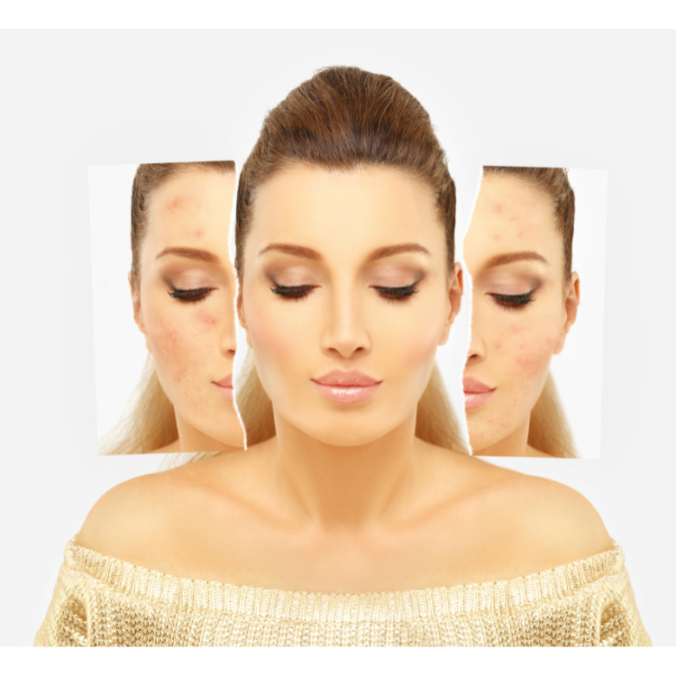 before after - Joven Skin Hair & Laser Clinic