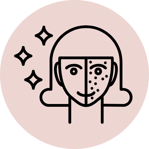icon pigmentation - Joven Skin Hair & Laser Clinic