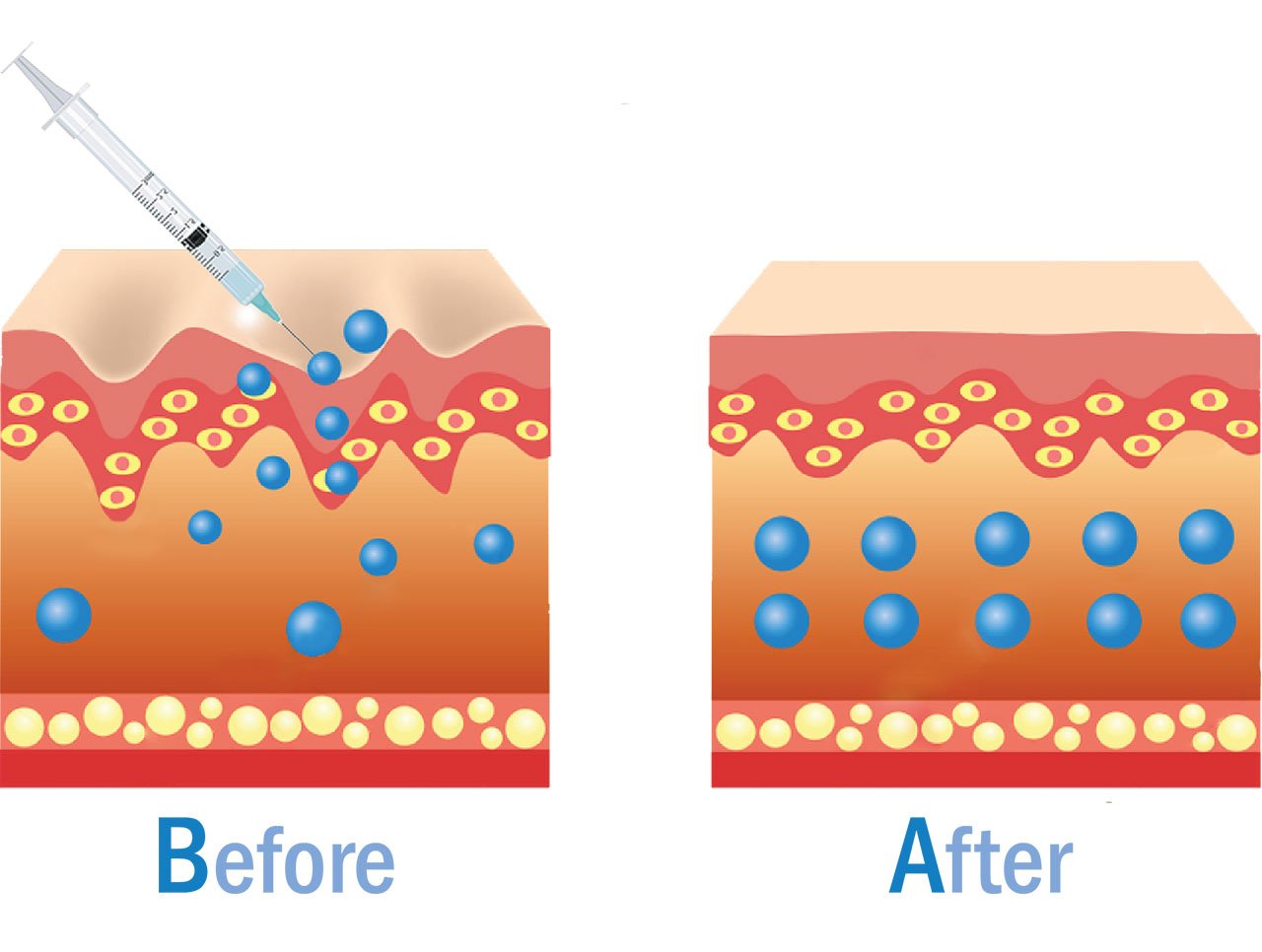 skin boosters